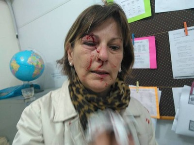 Márcia Friggi, professora agredida por um aluno de 15 anos, em Santa Catarina. 