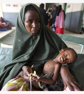 Mulher segura seu filho subnutrido em Mogadishu, na Somália.Cada vez mais crianças pequenas desnutridas estão morrendo no país. 