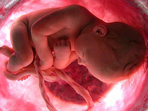 Aborto, um mal que clama aos céus