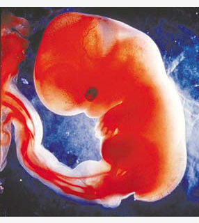 'Inclusive pra própria mulher o aborto faz muito mal, tanto do ponto de vista físico quanto psíquico', destacou dra. lenise