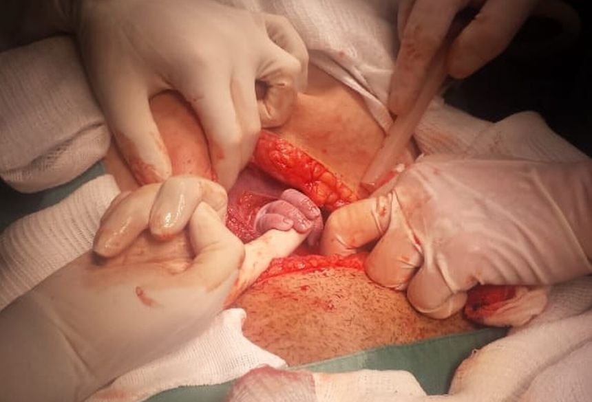 Avó registra momento em que bebê nasce e segura dedo de médica em MS — Foto: Ana Rego/Arquivo Pessoal