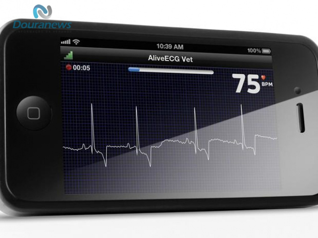 O AliveCor funciona como um eletrocardiograma portátil 
Foto: Getty Images