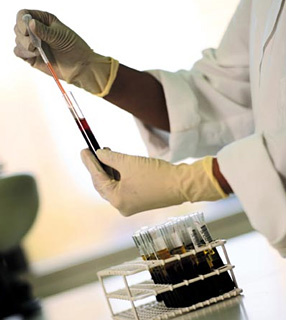 Um exame de sangue simples pode ser capaz de diagnosticar o mal de Alzheimer